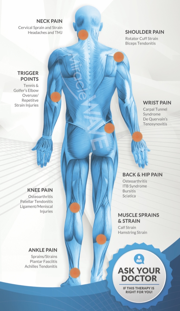 Shockwave Therapy in  Wichita, KS 