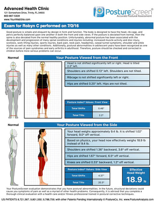 Posture Correction in Wichita, KS