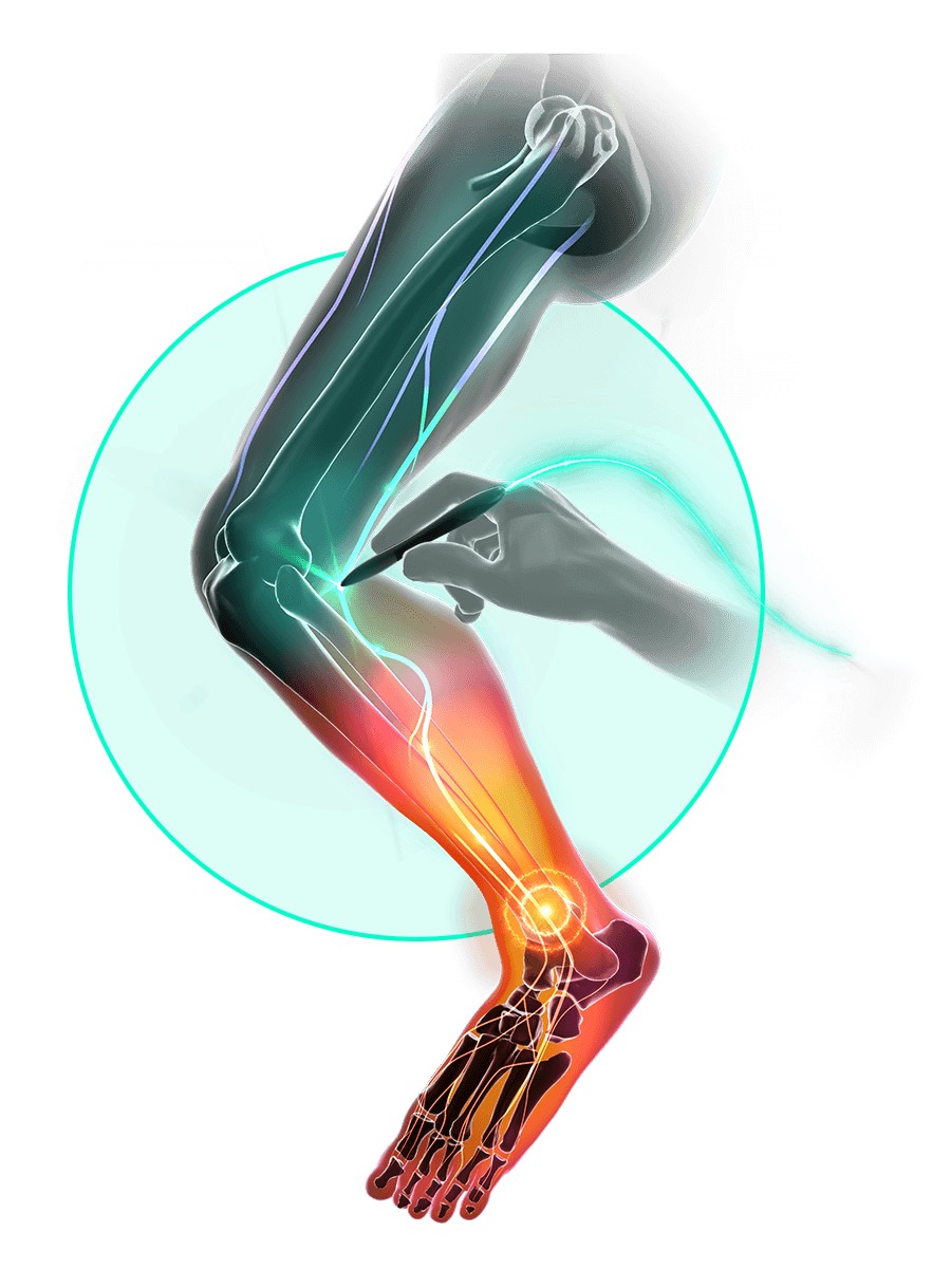 What Is Stimpod PRF Therapy?